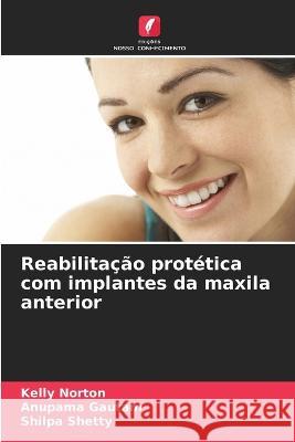 Reabilitacao protetica com implantes da maxila anterior Kelly Norton Anupama Gautam Shilpa Shetty 9786206032502 Edicoes Nosso Conhecimento - książka