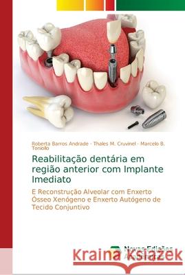 Reabilitação dentária em região anterior com Implante Imediato Barros Andrade, Roberta 9786139660407 Novas Edicioes Academicas - książka