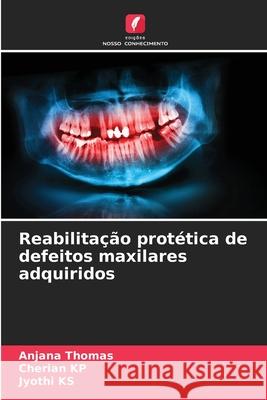 Reabilitação protética de defeitos maxilares adquiridos Anjana Thomas, Cherian Kp, Jyothi Ks 9786204154848 Edicoes Nosso Conhecimento - książka