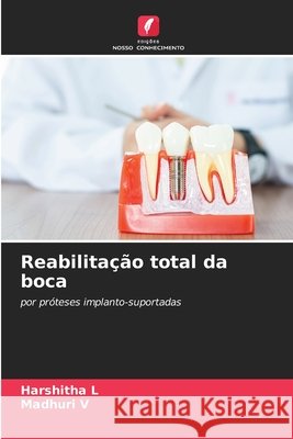 Reabilitação total da boca L, Harshitha, V, Madhuri 9786209572487 Edições Nosso Conhecimento - książka