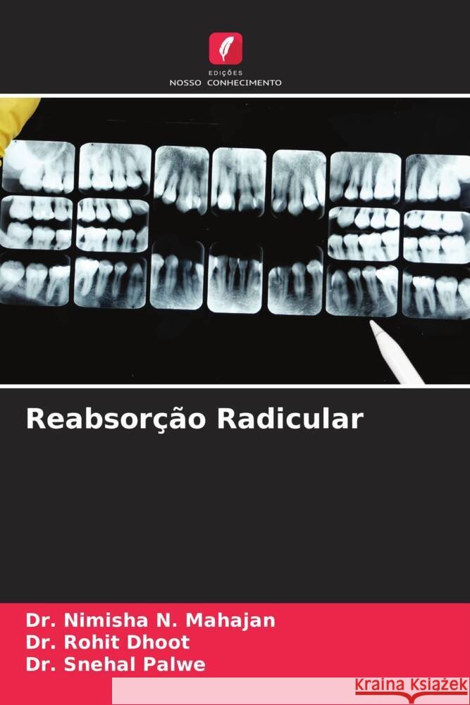 Reabsor??o Radicular Nimisha N. Mahajan Rohit Dhoot Snehal Palwe 9786206669869 Edicoes Nosso Conhecimento - książka