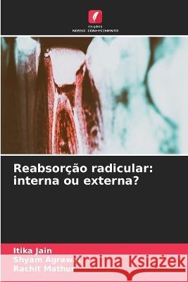 Reabsorcao radicular: interna ou externa? Itika Jain Shyam Agrawal Rachit Mathur 9786206097877 Edicoes Nosso Conhecimento - książka