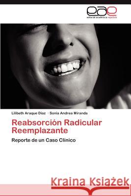 Reabsorción Radicular Reemplazante Araque Diaz Lilibeth 9783844349627 Editorial Acad Mica Espa Ola - książka