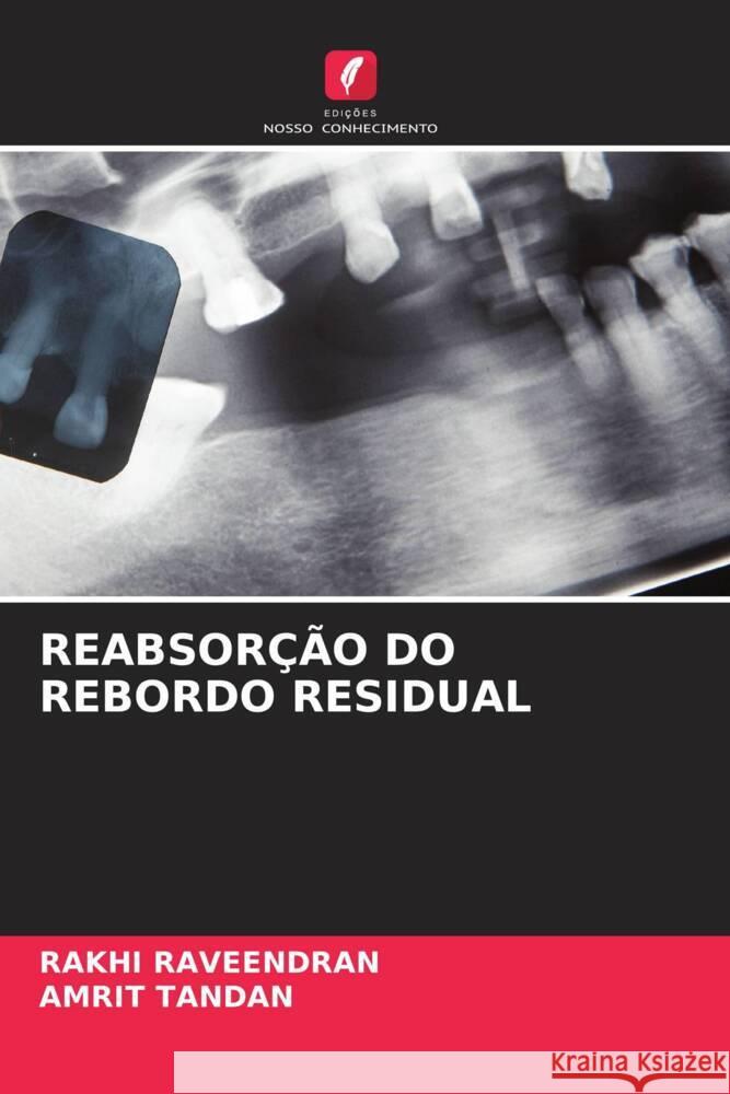 REABSORÇÃO DO REBORDO RESIDUAL RAVEENDRAN, RAKHI, Tandan, Amrit 9786206293330 Edições Nosso Conhecimento - książka