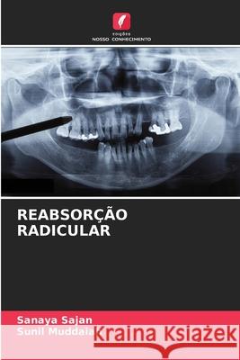 REABSORÇÃO RADICULAR Sajan, Sanaya, Muddaiah, Sunil 9786202329477 Edições Nosso Conhecimento - książka