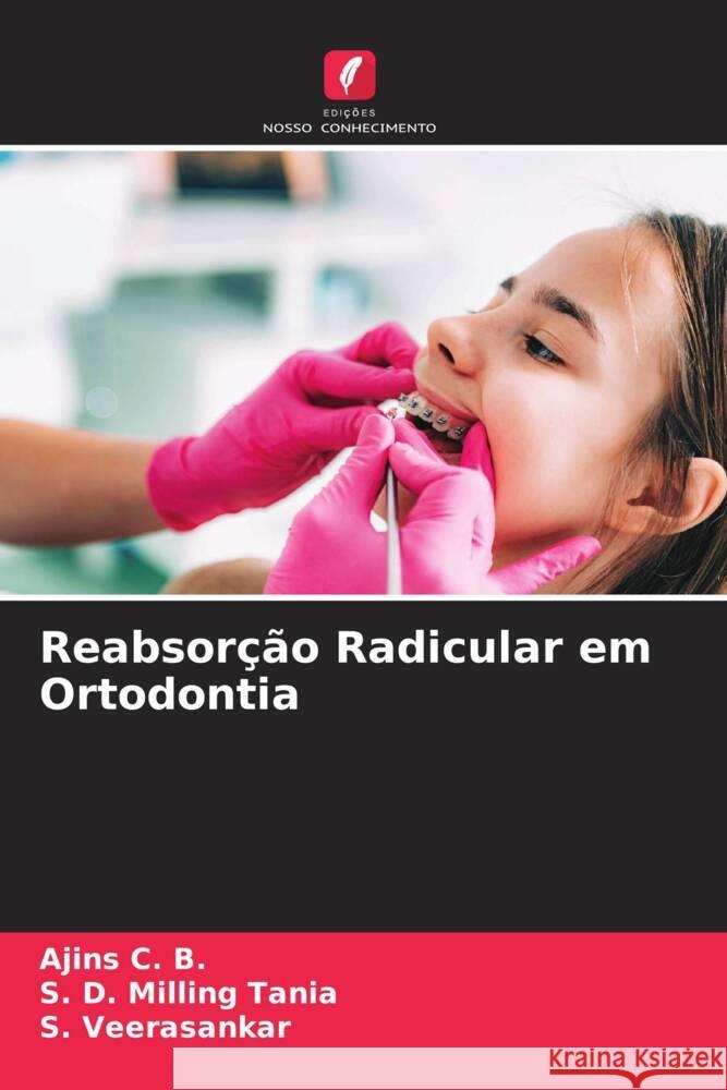 Reabsor??o Radicular em Ortodontia Ajins C S. D. Millin S. Veerasankar 9786206883821 Edicoes Nosso Conhecimento - książka