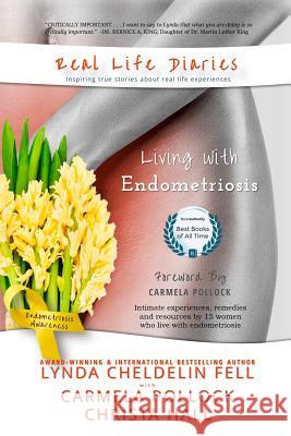 Real Life Diaries: Living with Endometriosis Lynda Cheldeli Carmela Pollock Christa Hall 9781944328528 Alyblue Media - książka