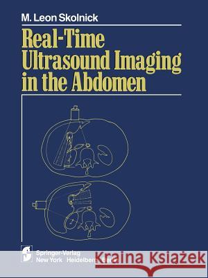 Real-Time Ultrasound Imaging in the Abdomen Skolnick, M. L. 9781461259213 Springer - książka