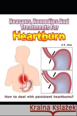 Reasons, Remedies And Treatments For Heartburns: How to Deal with Persistent Heartburns? C X Cruz 9798538072996 Independently Published - książka