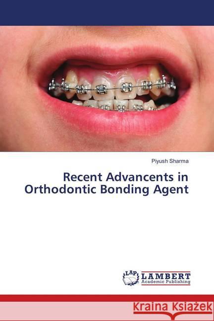 Recent Advancents in Orthodontic Bonding Agent Sharma, Piyush 9783659742514 LAP Lambert Academic Publishing - książka