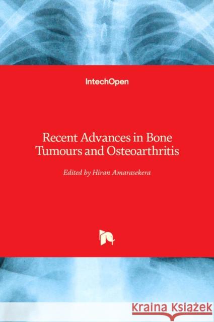 Recent Advances in Bone Tumours and Osteoarthritis Hiran Amarasekera 9781839689239 Intechopen - książka
