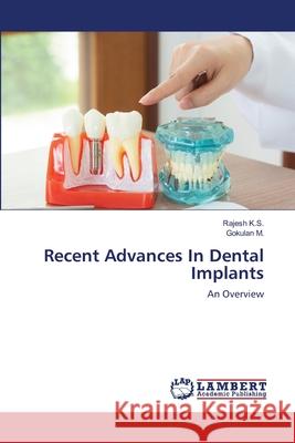 Recent Advances In Dental Implants Rajesh K Gokulan M 9786203462883 LAP Lambert Academic Publishing - książka
