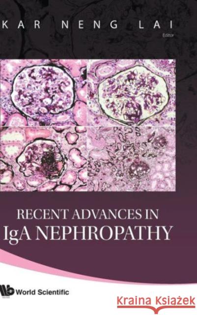 Recent Advances in IGA Nephropathy Lai, Kar Neng 9789812835864 World Scientific Publishing Company - książka