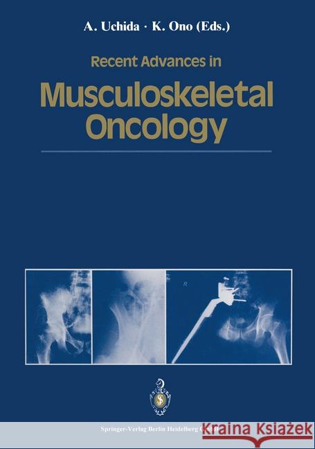 Recent Advances in Musculoskeletal Oncology Atsumasa Uchida Keiro Ono 9784431700999 Springer-Verlag - książka