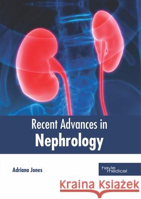 Recent Advances in Nephrology Adriana Jones 9781632416629 Hayle Medical - książka