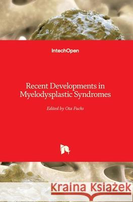 Recent Developments in Myelodysplastic Syndromes Ota Fuchs 9781789854770 Intechopen - książka