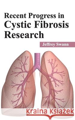 Recent Progress in Cystic Fibrosis Research Jeffrey Swann 9781632423498 Foster Academics - książka