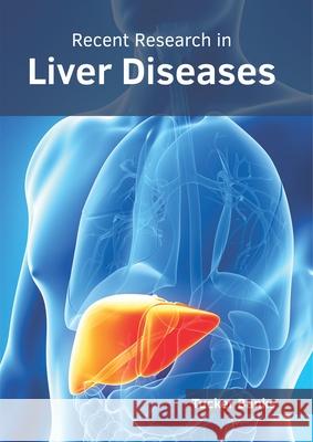 Recent Research in Liver Diseases Tucker Banks 9781632416407 Hayle Medical - książka