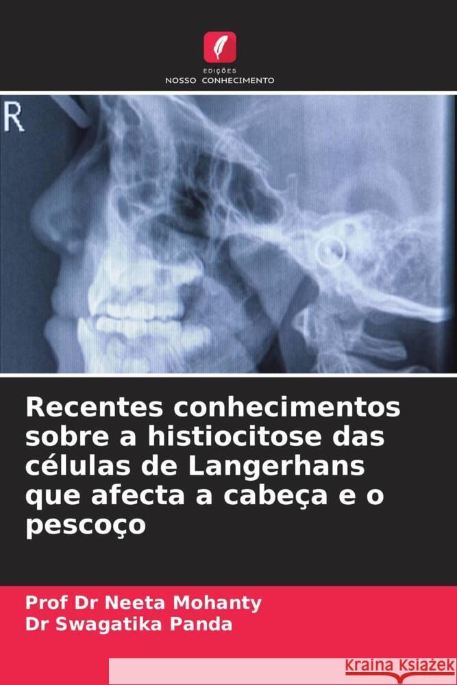 Recentes conhecimentos sobre a histiocitose das células de Langerhans que afecta a cabeça e o pescoço Mohanty, Prof Dr Neeta, Panda, Dr Swagatika 9786208326906 Edições Nosso Conhecimento - książka