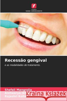Recessão gengival Mangrolia, Shefali, Ikhar, Aishwarya, Kolte, Rajashri 9786208006068 Edições Nosso Conhecimento - książka