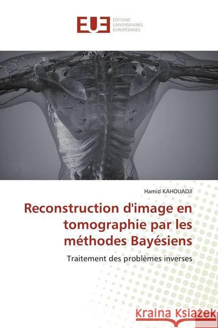 Reconstruction d'image en tomographie par les méthodes Bayésiens : Traitement des problèmes inverses KAHOUADJI, Hamid 9786139522590 Éditions universitaires européennes - książka