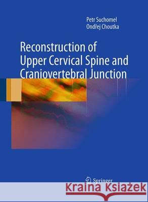 Reconstruction of Upper Cervical Spine and Craniovertebral Junction Petr Suchomel Ondrej Choutka 9783642422263 Springer - książka