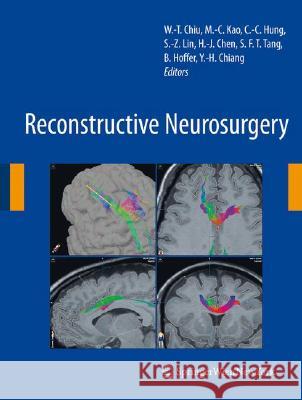 Reconstructive Neurosurgery  9783211782040 SPRINGER-VERLAG, AUSTRIA - książka