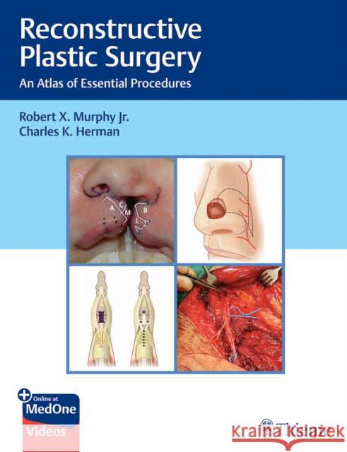 Reconstructive Plastic Surgery: An Atlas of Essential Procedures Robert Murphy Charles Herman 9781626235175 Thieme Medical Publishers - książka