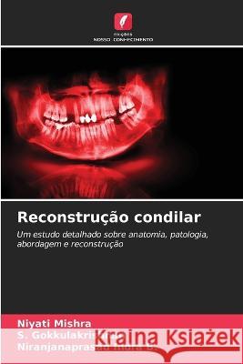 Reconstru??o condilar Niyati Mishra S. Gokkulakrishnan Niranjanaprasad Indr 9786205661864 Edicoes Nosso Conhecimento - książka