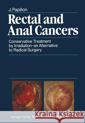 Rectal and Anal Cancers: Conservative Treatment by Irradiation -- An Alternative to Radical Surgery Beahrs, O. H. 9783642686153 Springer - książka