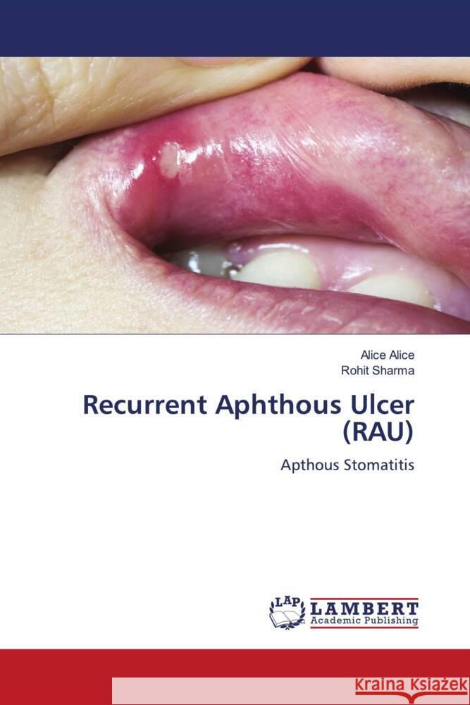 Recurrent Aphthous Ulcer (RAU) Alice Alice Rohit Sharma 9786207461332 LAP Lambert Academic Publishing - książka