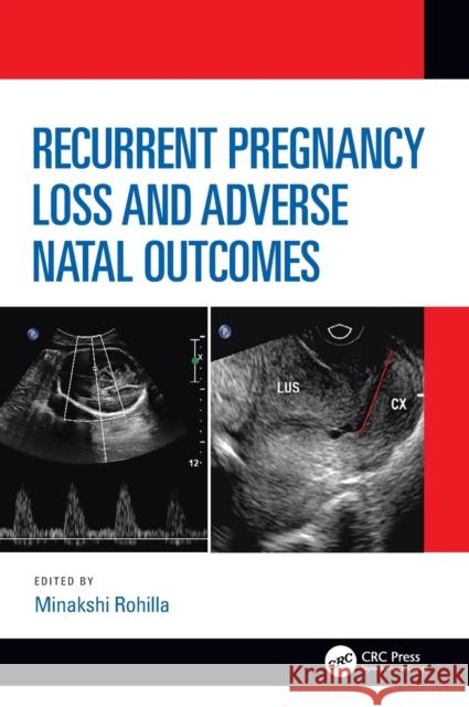 Recurrent Pregnancy Loss and Adverse Natal Outcomes Minakshi Rohilla 9781138351820 CRC Press - książka