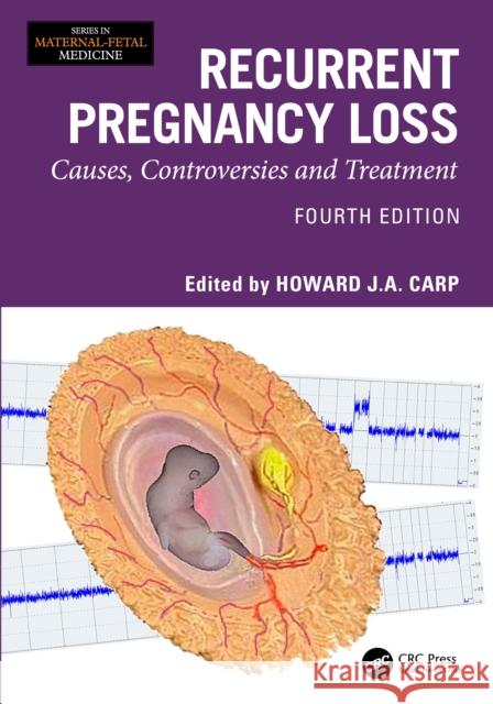 Recurrent Pregnancy Loss: Causes, Controversies and Treatment Howard J. a. Carp 9781032825243 CRC Press - książka