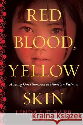 Red Blood, Yellow Skin Linda L. T. Baer 9781632990273 River Grove Books - książka