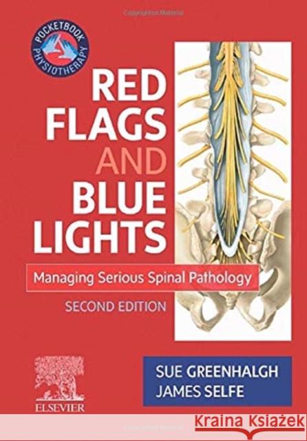 Red Flags and Blue Lights: Managing Serious Spinal Pathology Sue Greenhalgh James Selfe 9780702055102 Elsevier - książka