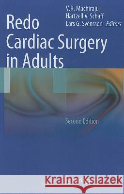 Redo Cardiac Surgery in Adults  9781461413257 Springer, Berlin - książka