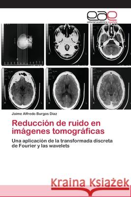 Reducción de ruido en imágenes tomográficas Burgos Díaz, Jaime Alfredo 9783659045707 Editorial Academica Espanola - książka