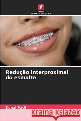 Redu??o interproximal do esmalte Kunal Patil 9786205614341 Edicoes Nosso Conhecimento - książka