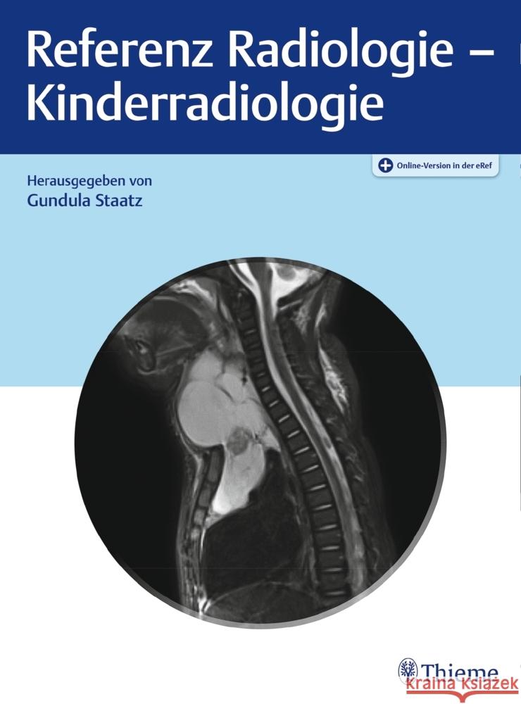 Referenz Radiologie - Kinderradiologie  9783132418660 Thieme, Stuttgart - książka