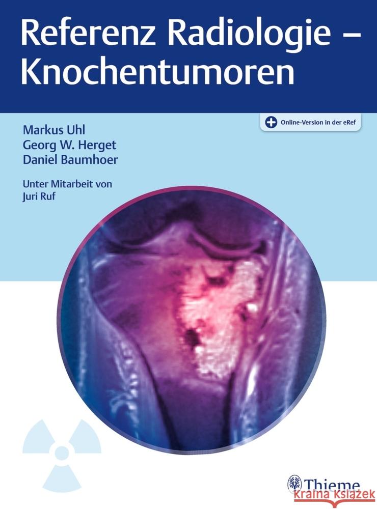 Referenz Radiologie - Knochentumoren Uhl, Markus, Herget, Georg W., Baumhoer, Daniel 9783132439306 Thieme, Stuttgart - książka