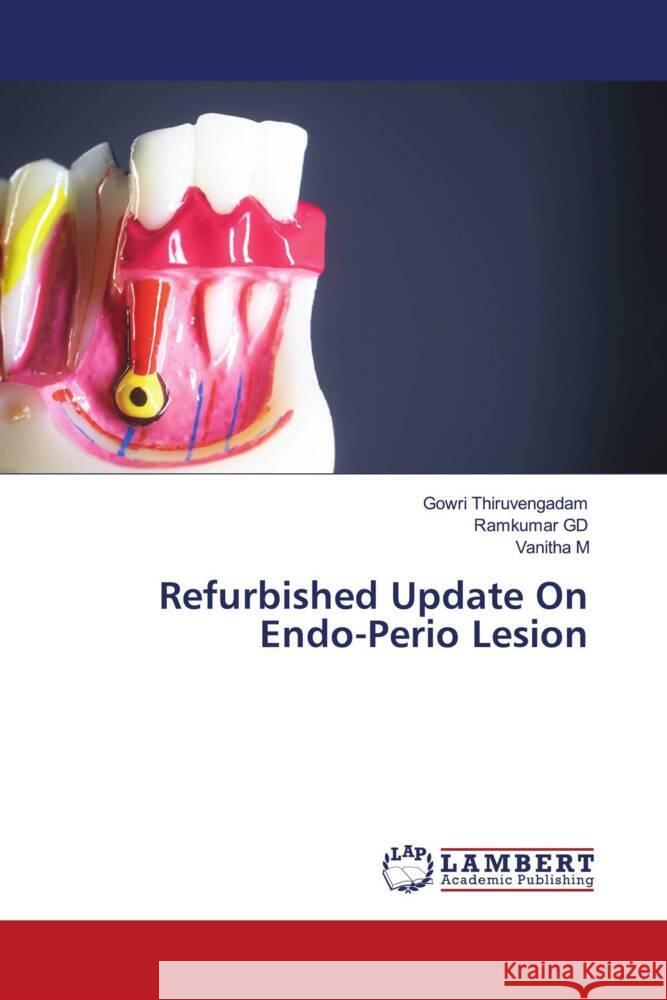 Refurbished Update On Endo-Perio Lesion Thiruvengadam, Gowri, GD, Ramkumar, M, Vanitha 9786205493311 LAP Lambert Academic Publishing - książka