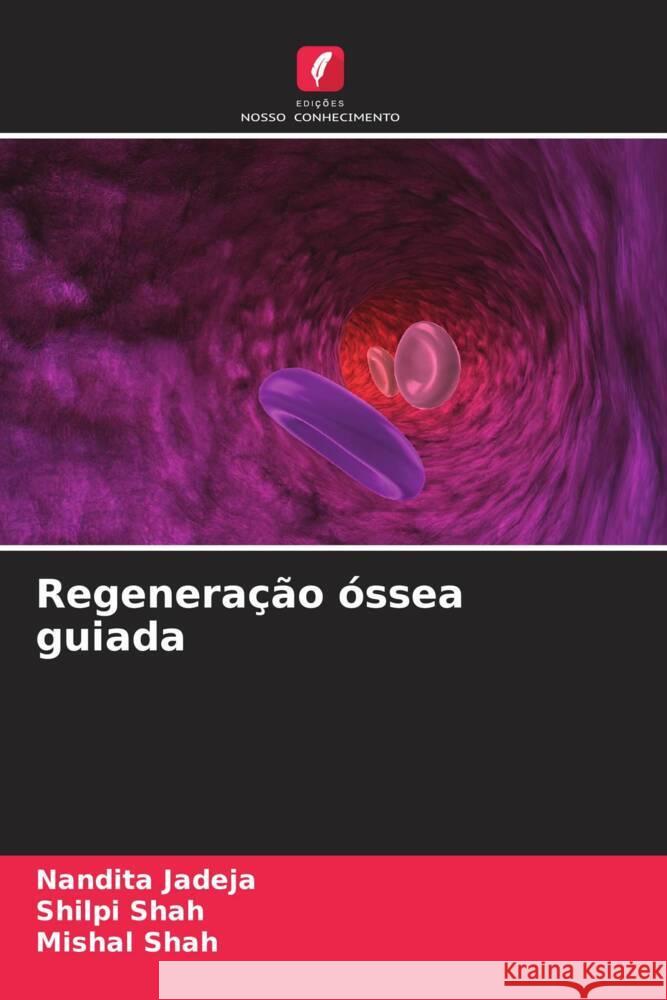 Regenera??o ?ssea guiada Nandita Jadeja Shilpi Shah Mishal Shah 9786206685043 Edicoes Nosso Conhecimento - książka