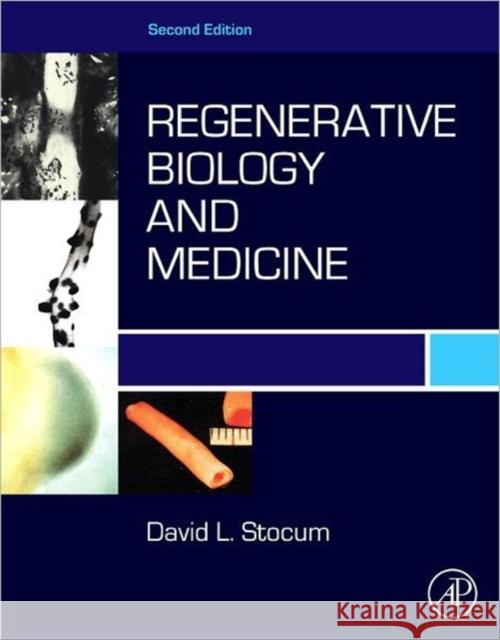 Regenerative Biology and Medicine David Stocum 9780123848604 ELSEVIER - książka