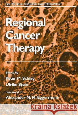 Regional Cancer Therapy Peter M. Schlag Ulrike Stein Alexander M. M. Eggermont 9781588296726 Humana Press - książka
