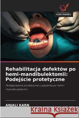 Rehabilitacja defektów po hemi-mandibulektomii: Podejscie protetyczne KARN, ANJALI 9786209252235 Wydawnictwo Nasza Wiedza - książka