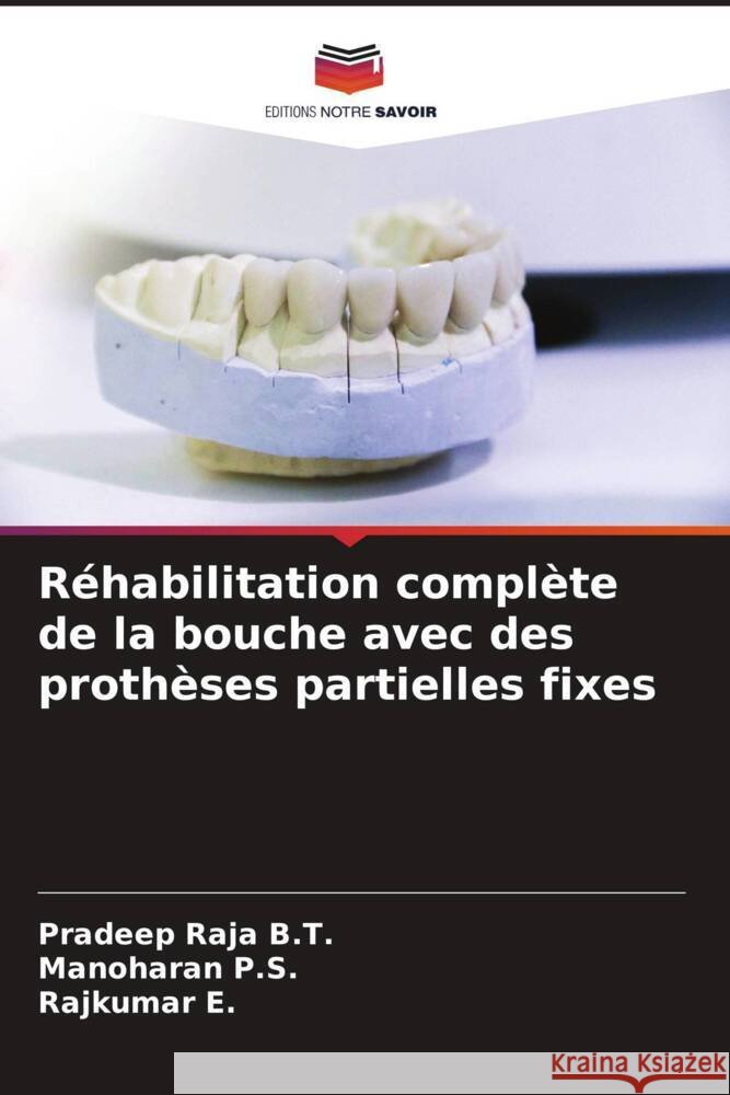 Réhabilitation complète de la bouche avec des prothèses partielles fixes B.T., Pradeep Raja, P.S., Manoharan, E., Rajkumar 9786204666099 Editions Notre Savoir - książka
