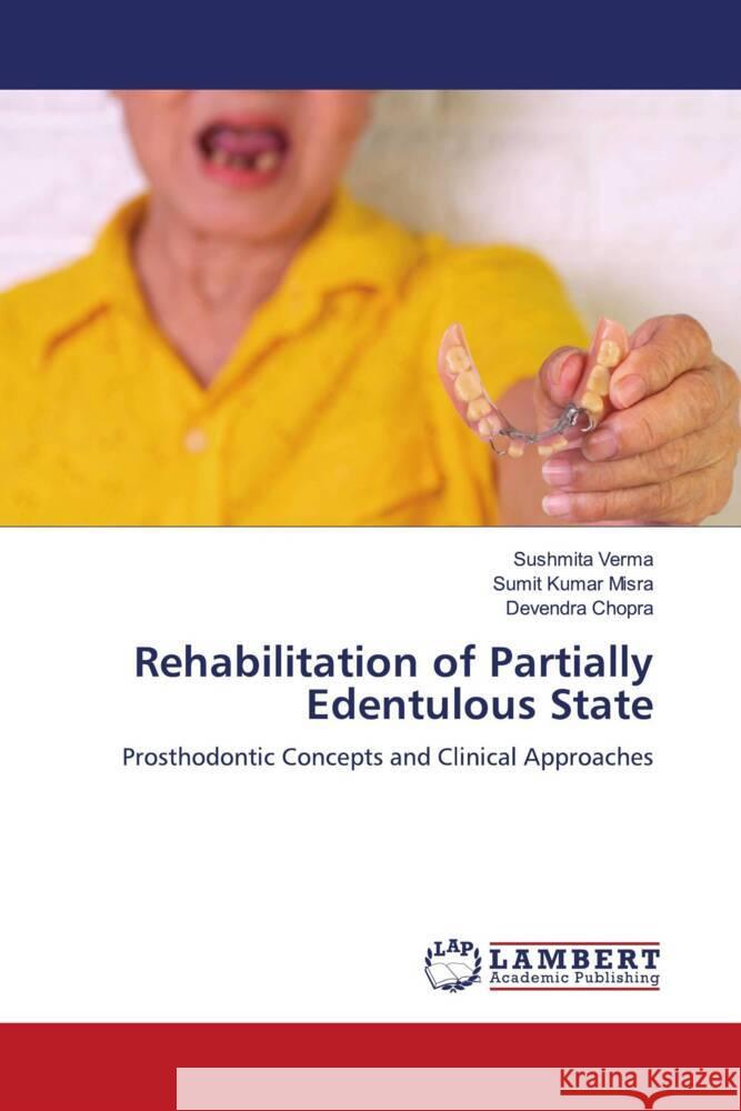 Rehabilitation of Partially Edentulous State Verma, Sushmita, Kumar Misra, Sumit, Chopra, Devendra 9786206786528 LAP Lambert Academic Publishing - książka