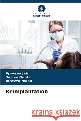 Reimplantation Jain, Apoorva, Gupta, Sachin, Nikhil, Vineeta 9786200749192 Verlag Unser Wissen - książka