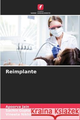 Reimplante Jain, Apoorva, Gupta, Sachin, Nikhil, Vineeta 9786200749222 Edições Nosso Conhecimento - książka