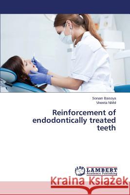Reinforcement of endodontically treated teeth Baisoya Sonam, Nikhil Vineeta 9783659801198 LAP Lambert Academic Publishing - książka
